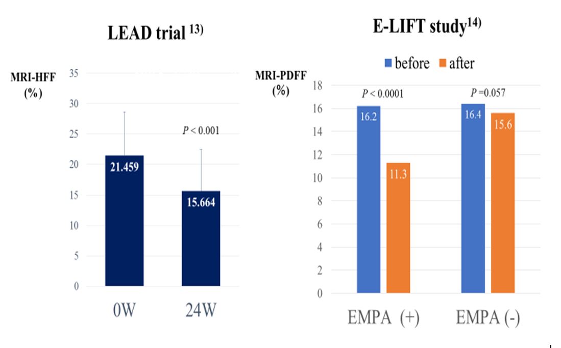 Hepatoprotective Effect of SGLT2 Inhibitor on Nonalcoholic Fatty Liver ...